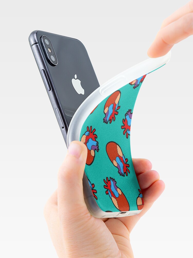 Alternate view of Anatomical Heart Pattern iPhone Case & Cover