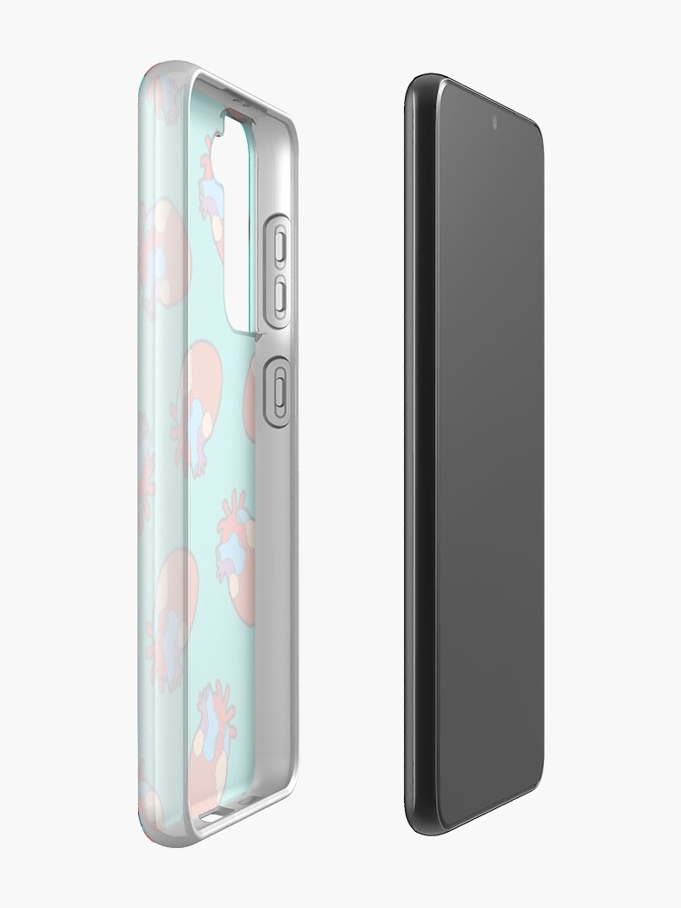 Alternate view of Anatomical Heart Pattern Case & Skin for Samsung Galaxy