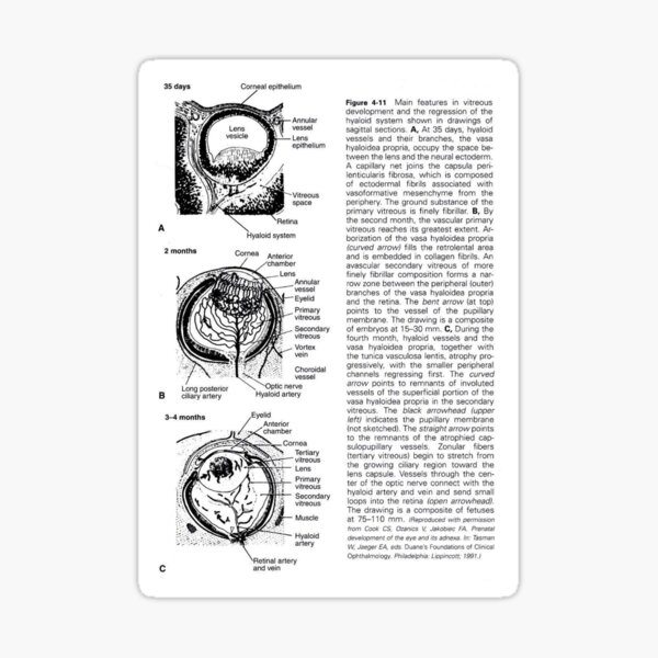 Item preview, sick human eye designed and sold by dudor.