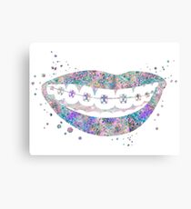 Teeth braces, dental anatomy Canvas Print