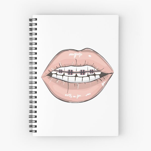 Item preview, Lips braces designed and sold by Milatoo.