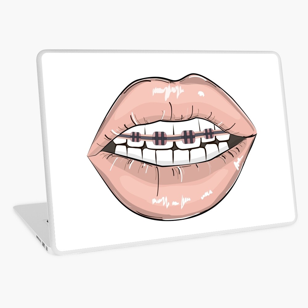 Vinilo Para Portatil Tirantes De Labios De Milatoo Redbubble