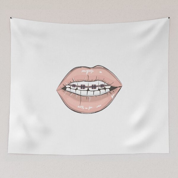 Item preview, Lips braces designed and sold by Milatoo.