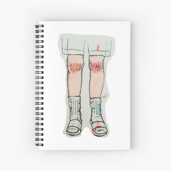 Bruises On Both My Knees Spiral Notebook