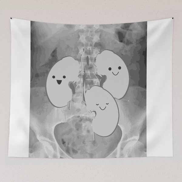 Item preview, Kidney Transplant Recipient  designed and sold by partsypants.