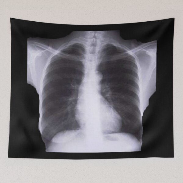 Item preview, X-RAYS designed and sold by AMARILLO1.