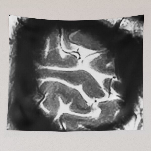 Item preview, CONTRAST MRI designed and sold by MissScientastic.