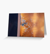 Contagion Greeting Card