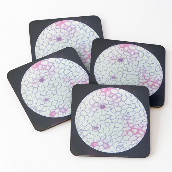 Item preview, Plant Cells Under a Microscope designed and sold by eagleray.