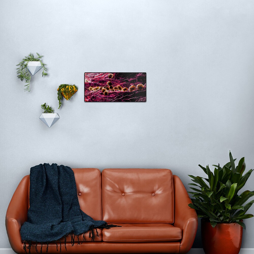 Snails Blood Metal Print