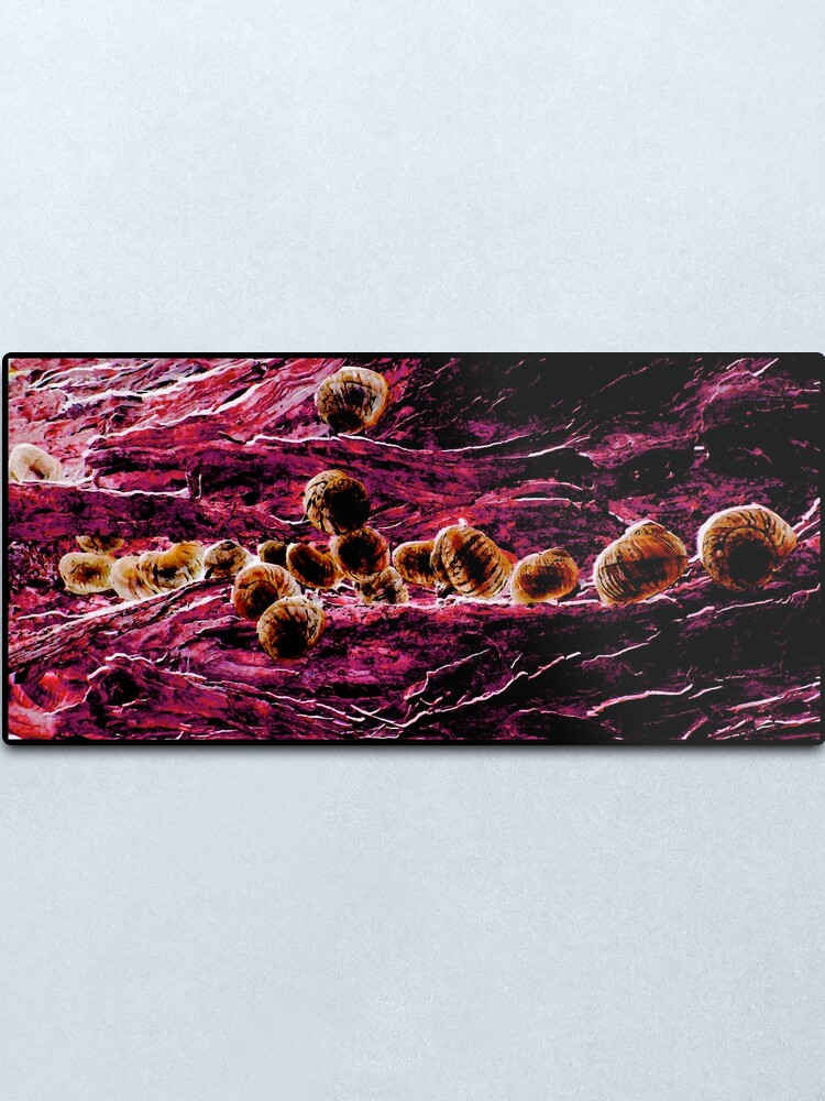 Alternate view of Snails Blood Metal Print