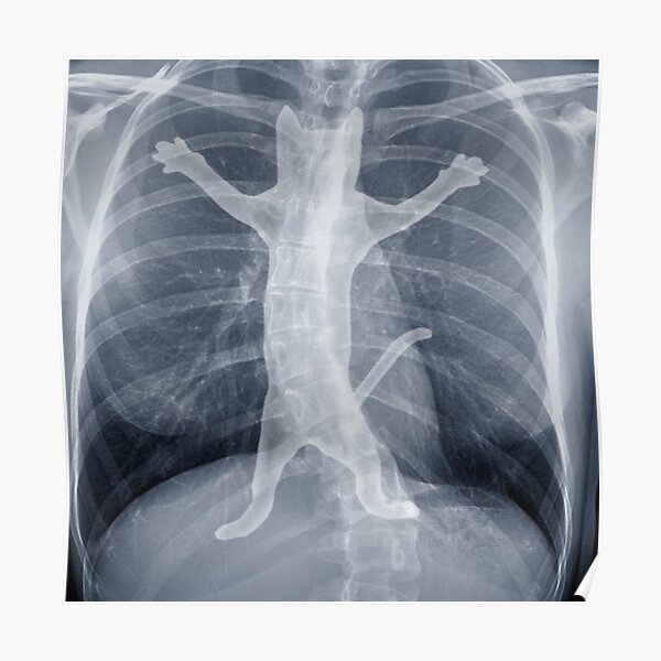 16+ Funny X Ray Images - NathalieAylin