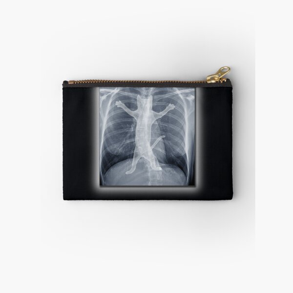 Item preview, X-ray designed and sold by tummeow.