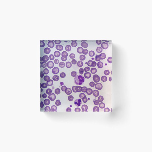 Item preview, Canine Distemper Virus Histology designed and sold by deltoid.