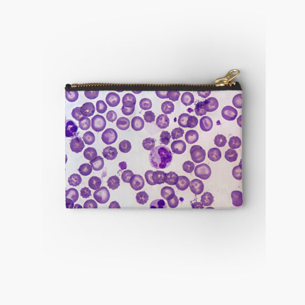 Item preview, Canine Distemper Virus Histology designed and sold by deltoid.