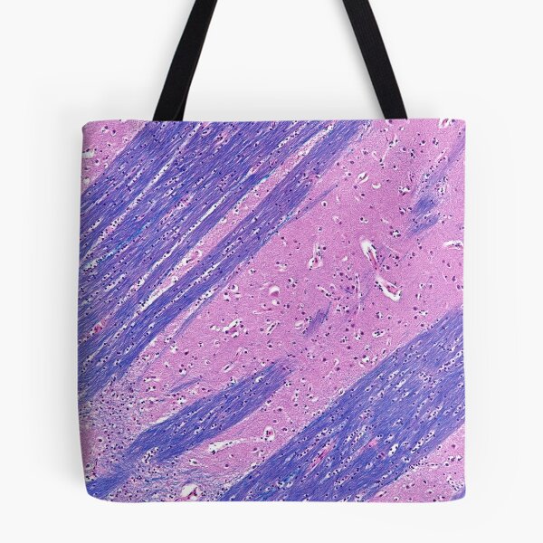 Item preview, Putamen Histology designed and sold by deltoid.