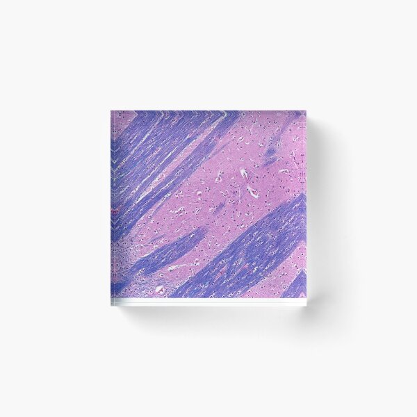 Item preview, Putamen Histology designed and sold by deltoid.