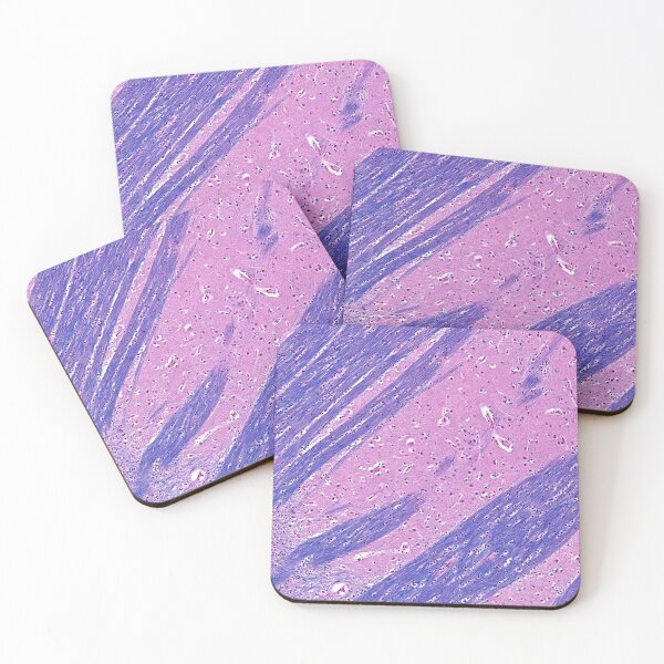 Item preview, Putamen Histology designed and sold by deltoid.