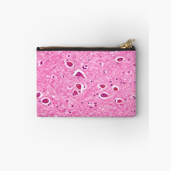 Item preview, Alzheimers Disease Histology designed and sold by deltoid.