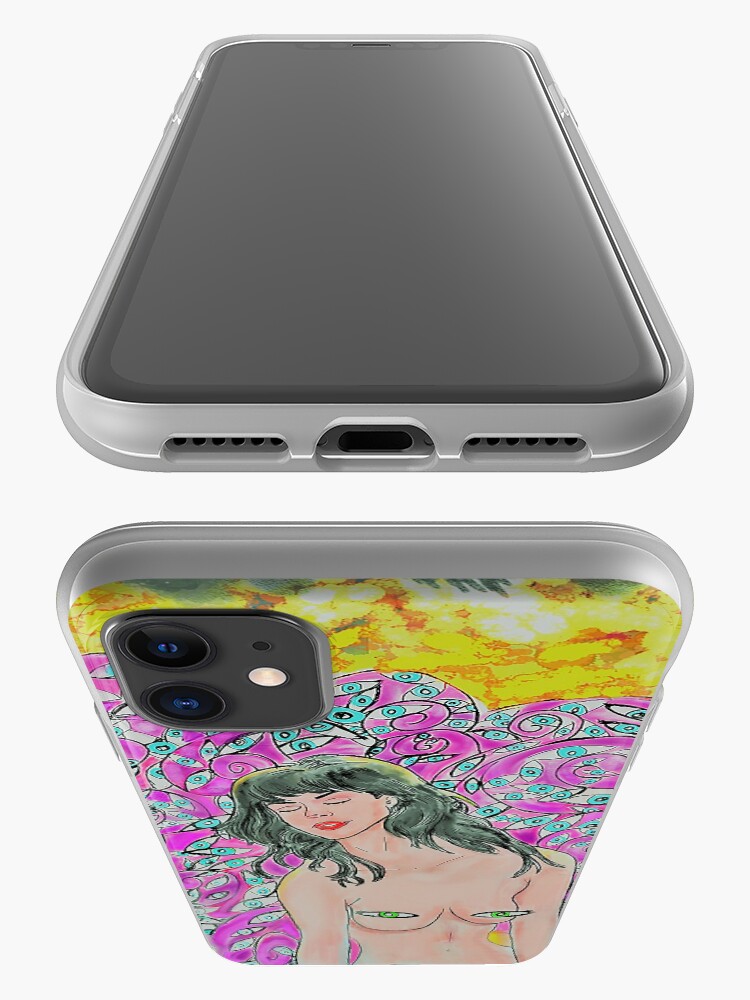 Alternate view of Nude Mangoes and Lost Things iPhone Case & Cover