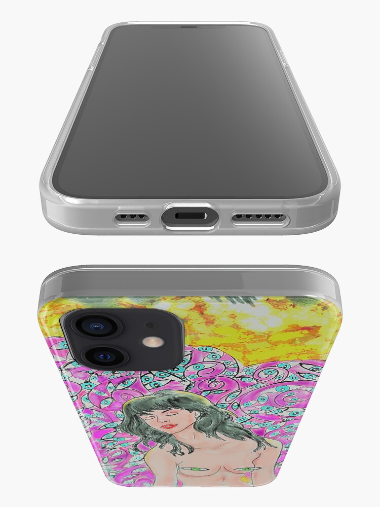 Alternate view of Nude Mangoes and Lost Things iPhone Case