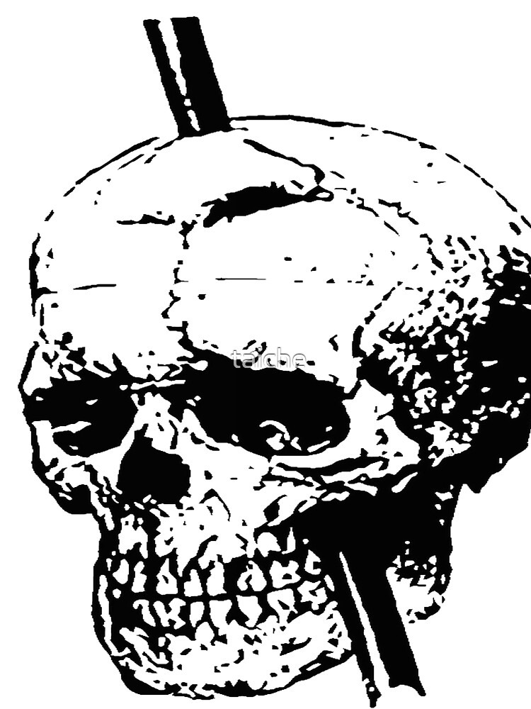 "Skull of Phineas Gage With Tamping Iron" Tshirt by taiche Redbubble