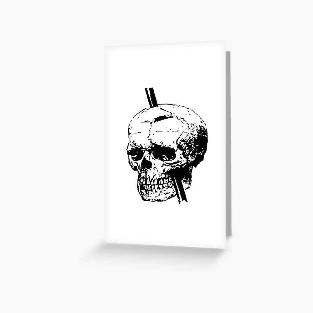 Skull Of Phineas Gage With Tamping Iron Greeting Card By Taiche