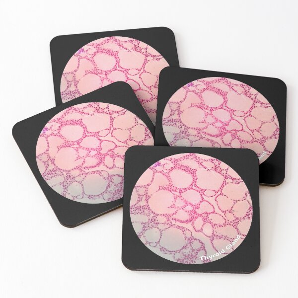 Item preview, Thyroid Gland designed and sold by MVanHyll.