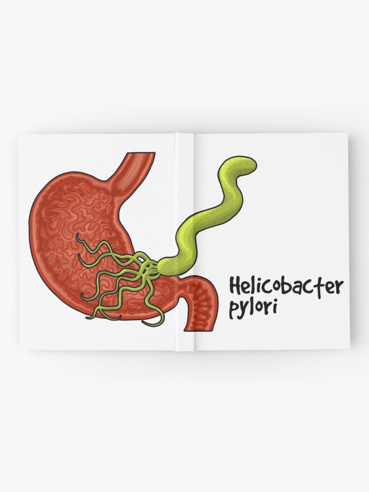 Alternate view of Helicobacter pylori Hardcover Journal