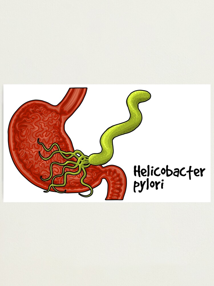 Alternate view of Helicobacter pylori Photographic Print