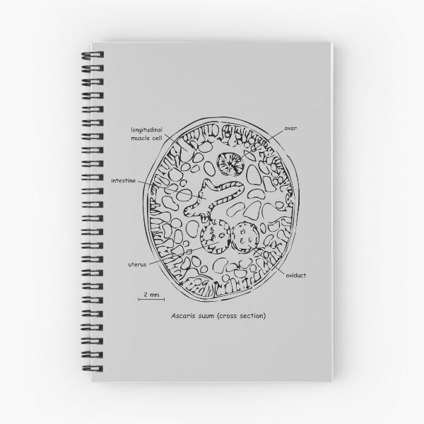 Item preview, Cross section of Ascaris suum, labelled designed and sold by RosArt100.