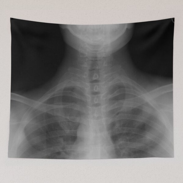 Item preview, Chest xray designed and sold by WeMadeOurWorld.