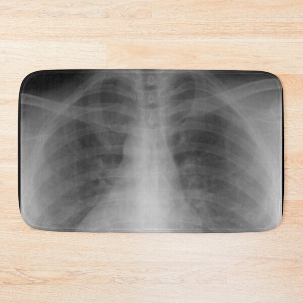 Item preview, Chest xray designed and sold by WeMadeOurWorld.