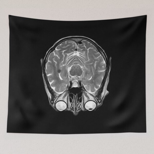 Item preview, MRI of the Brain designed and sold by WeMadeOurWorld.