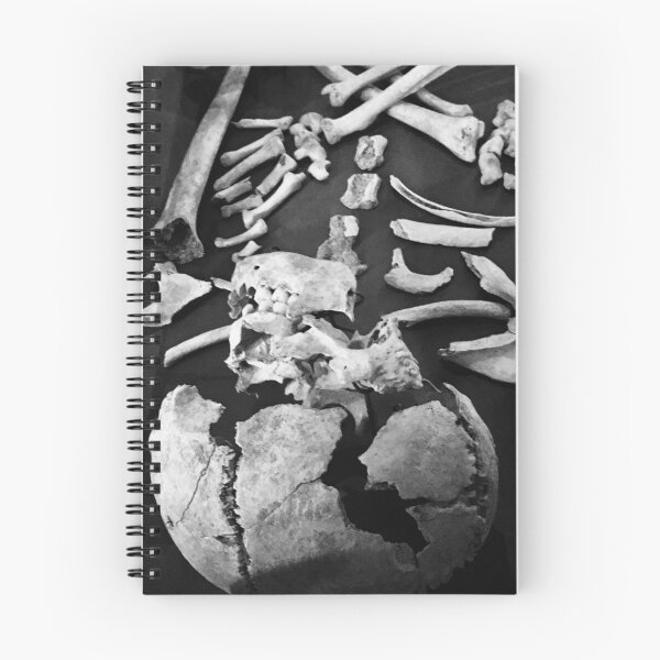 Item preview, Broken skeleton designed and sold by Mandi Collingridge.