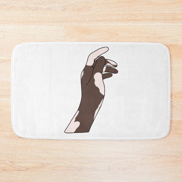 Item preview, Vitiligo skin designed and sold by Popcorn Art.