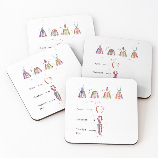 Item preview, Dental implant procedure, dental anatomy, dental implant designed and sold by Rosaliartbook.