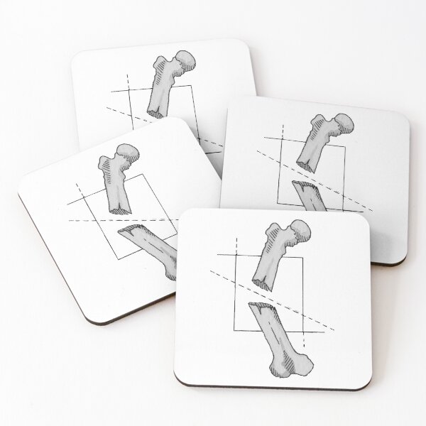 Item preview, Broken Bones designed and sold by Beeandink.