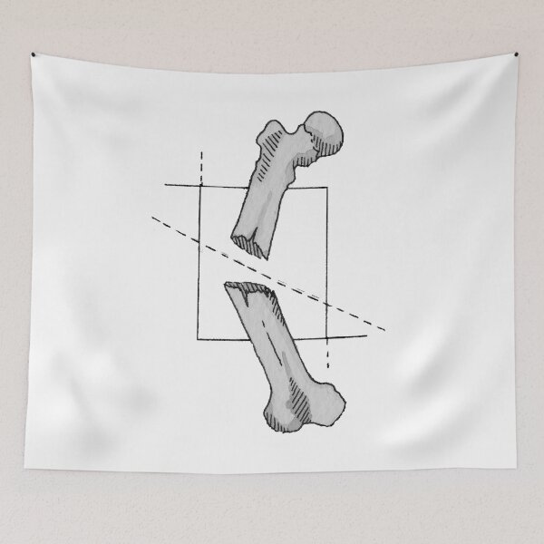 Item preview, Broken Bones designed and sold by Beeandink.