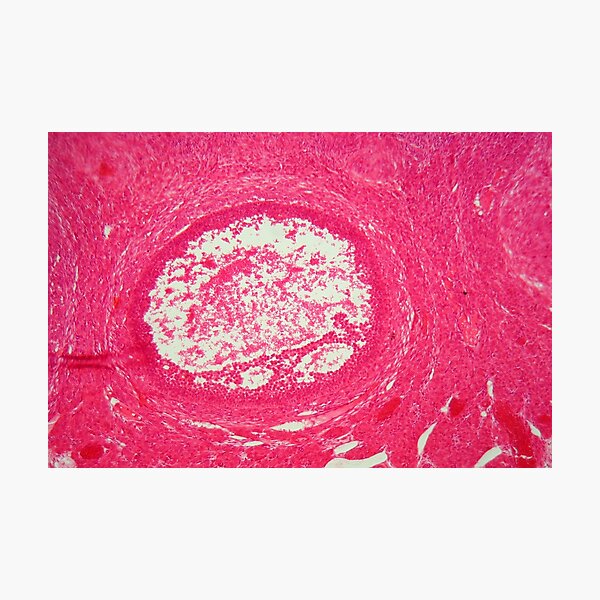 Item preview, Ovary cells under the microscope. designed and sold by Zosimus.