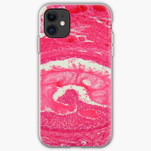 Ovary tissue under the microscope. iPhone Soft Case