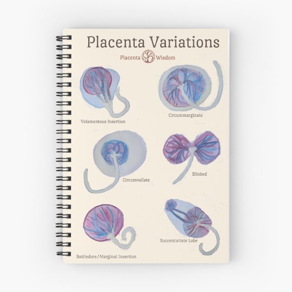 Item preview, Placenta Variations Teaching designed and sold by placentawisdom.