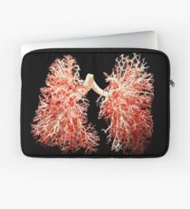 Real lungs - Respiratory system Laptop Sleeve