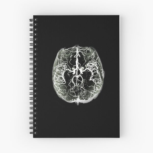 Item preview, Cerebral arteries designed and sold by Mykadodo.