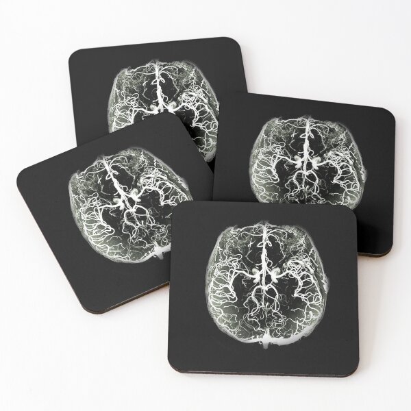 Item preview, Cerebral arteries designed and sold by Mykadodo.