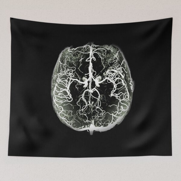Item preview, Cerebral arteries designed and sold by Mykadodo.