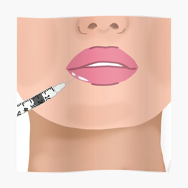 Lip Fillers Poster
