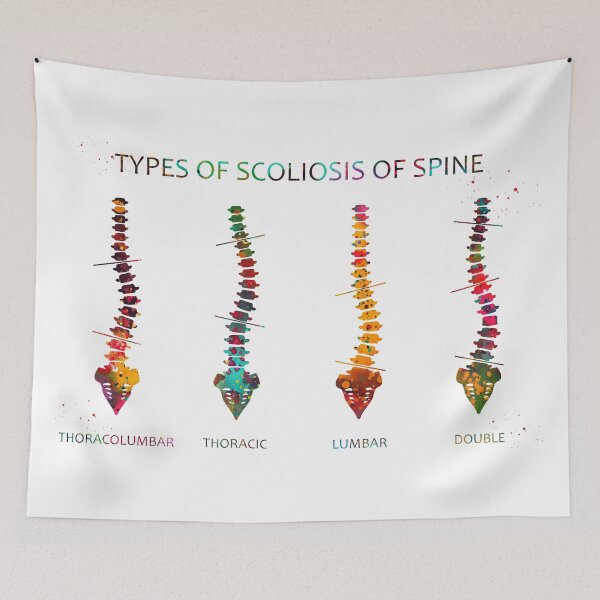 Item preview, Type of scoliosis of spine designed and sold by Liededrom..