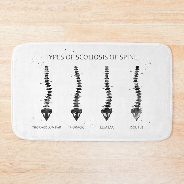 Item preview, Type of scoliosis of spine designed and sold by Liededrom..