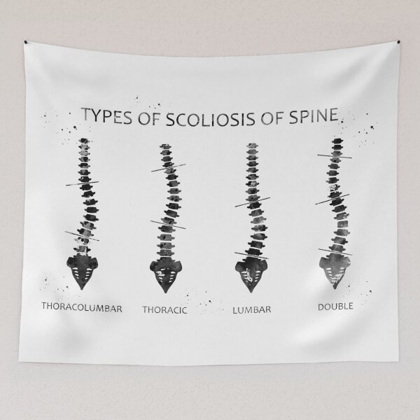 Item preview, Type of scoliosis of spine designed and sold by Liededrom..